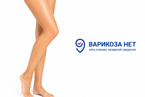 Передается ли варикоз по наследству? Как снизить риск заболевания, если варикоз был у родителей