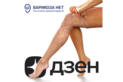 У сети клиник «Варикоза нет»  есть собственный Дзэн-канал! 